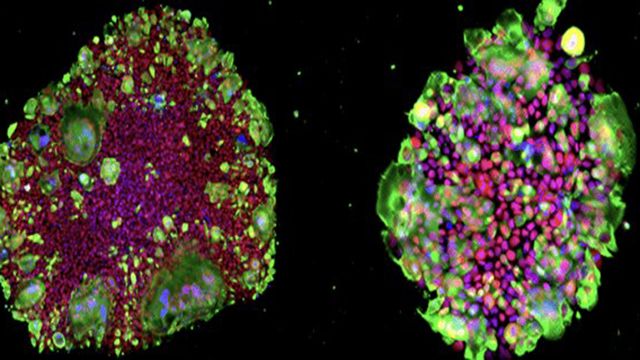 Staining images of ACE2-expressing iPS cells.